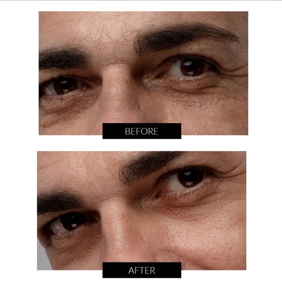 IRIS™ Illuminating eye massager - Picture 2 of 3